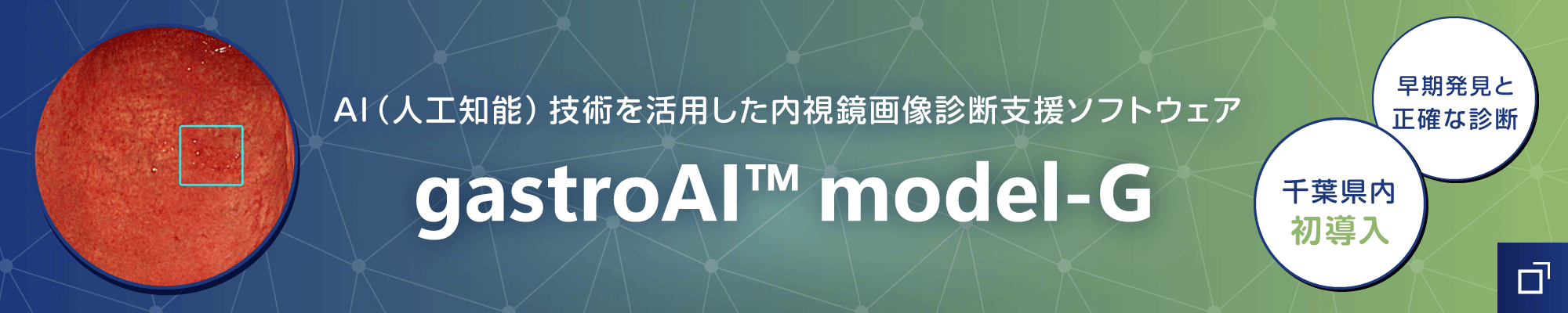 内視鏡画像診断支援ソフトウェア「gastroAI™ model-G」を導入